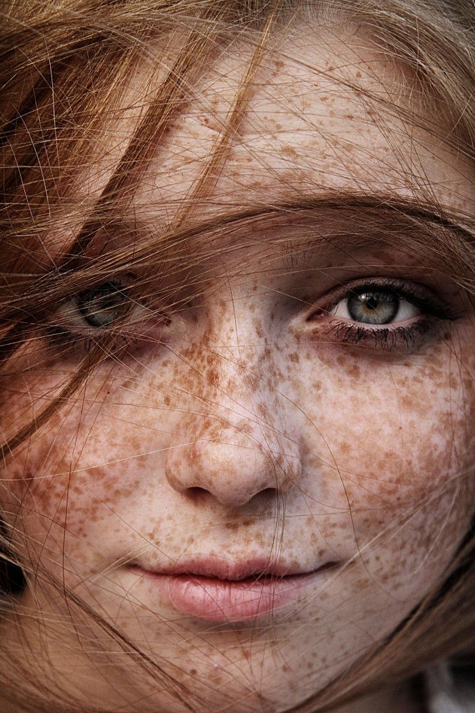 closeup freckles 2