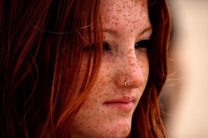 beautiful freckles